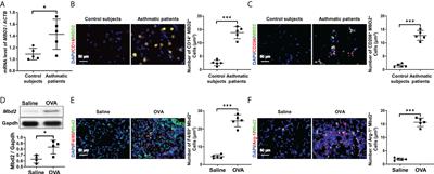 Blockade of Mbd2 by siRNA-loaded liposomes protects mice against OVA-induced allergic airway inflammation via repressing M2 macrophage production